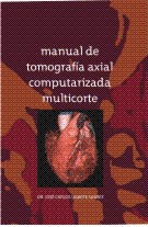Manual de tomografía axial computarizada multicorte